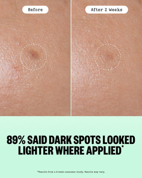 PEACE OUT dot applied to cheek, demonstrating targeted spot treatment benefit