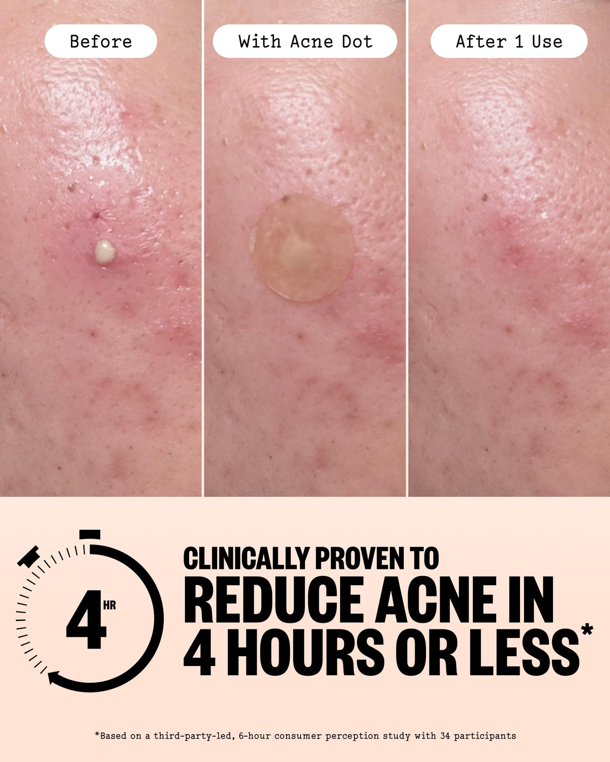 PEACE OUT Healing Dot close-up texture showing thicker hydrocolloid for absorption