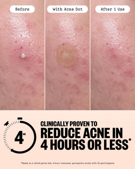 PEACE OUT Healing Dot close-up texture showing thicker hydrocolloid for absorption