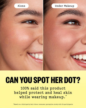 PEACE OUT Healing Dot on cheek in nighttime setting for focused overnight repair