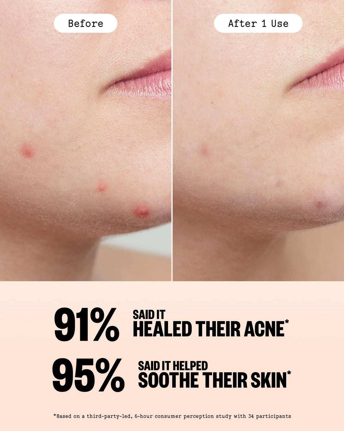 PEACE OUT patch used daytime under makeup offering subtle coverage benefit