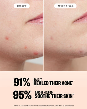 PEACE OUT patch used daytime under makeup offering subtle coverage benefit