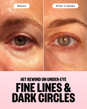 PEACE OUT stick being applied under eye demonstrating targeted delivery and precise control