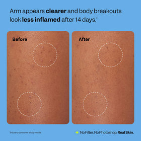 Peach Slices six patches laid out to show oversized coverage per patch
