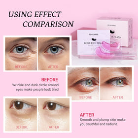 PEAUAMIE application photo placing patch under eye for puffiness reduction