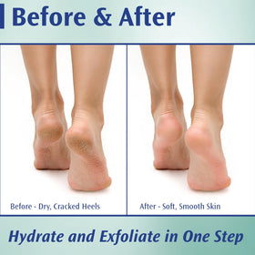 Pedifix cream texture close-up demonstrating rich, penetrating consistency