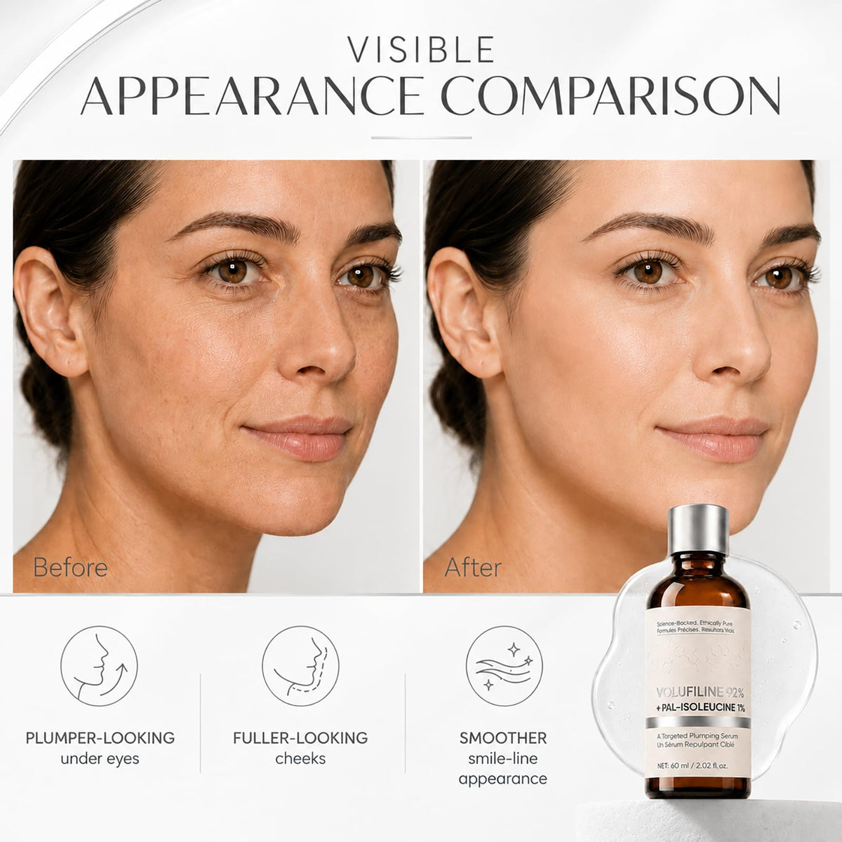 Peehss applied under-eye demonstrating targeted plumping and refreshed look