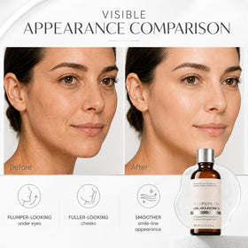 Peehss applied under-eye demonstrating targeted plumping and refreshed look