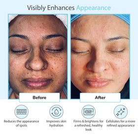 Perfect Image application on hand showing targeted exfoliation control