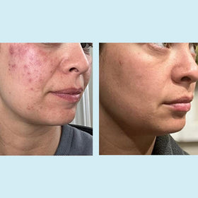 Perfect Image product with green tea leaves emphasizing antioxidant support