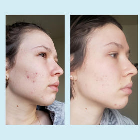Perfect Image retinol ingredient display illustrating renewal benefits