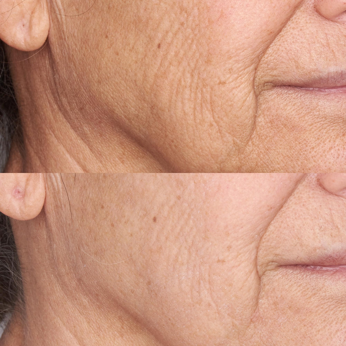 Perricone MD application on model demonstrates even coverage and radiant look