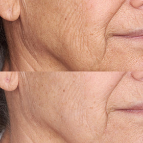 Perricone MD application on model demonstrates even coverage and radiant look