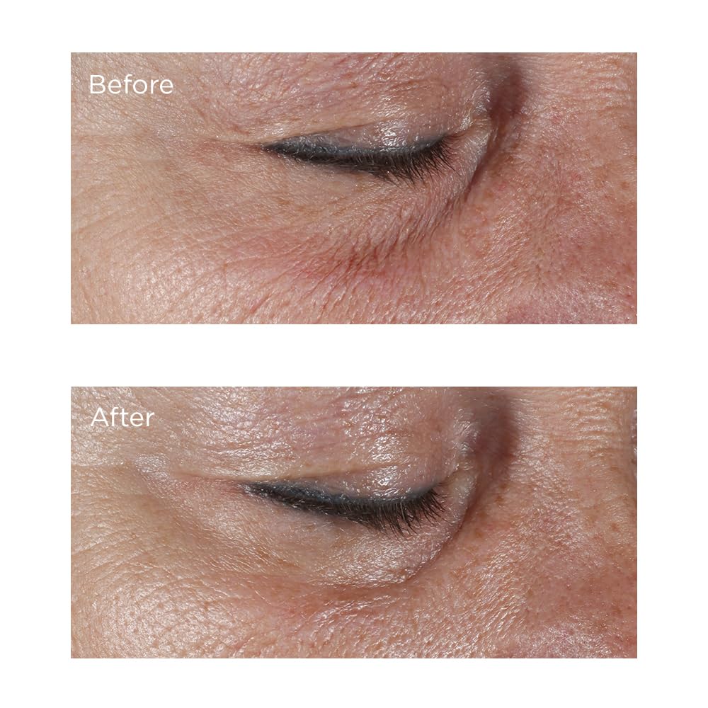 Perricone MD eye cream on bathroom vanity suggesting daily routine and brightening benefits