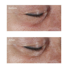 Perricone MD eye cream on bathroom vanity suggesting daily routine and brightening benefits