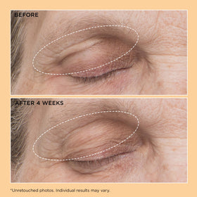 Perricone MD demonstration of gentle eyelid application for targeted lift