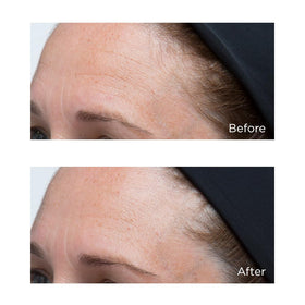 Perricone MD on vanity with skincare items conveying daily layering and routine benefit
