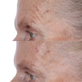 Perricone MD toner soaked on cotton pad demonstrating easy application