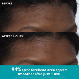 peter thomas roth applying oval tape to forehead for smoother lines