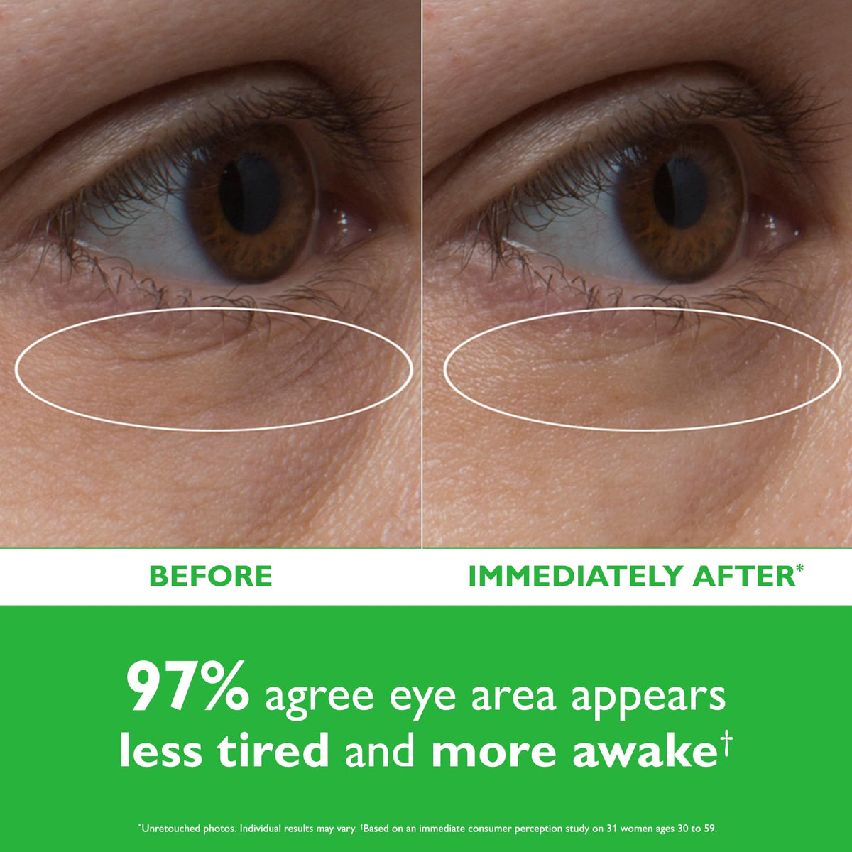Peter Thomas Roth close-up hydrogel texture illustrating hydration benefit