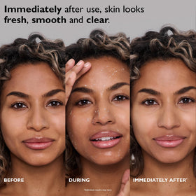 Peter Thomas Roth texture close-up highlighting gentle rolling gel action