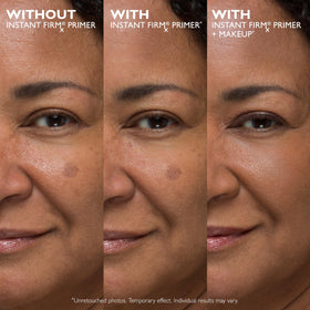 Peter Thomas Roth product applied on hand showcasing instant smoothing effect