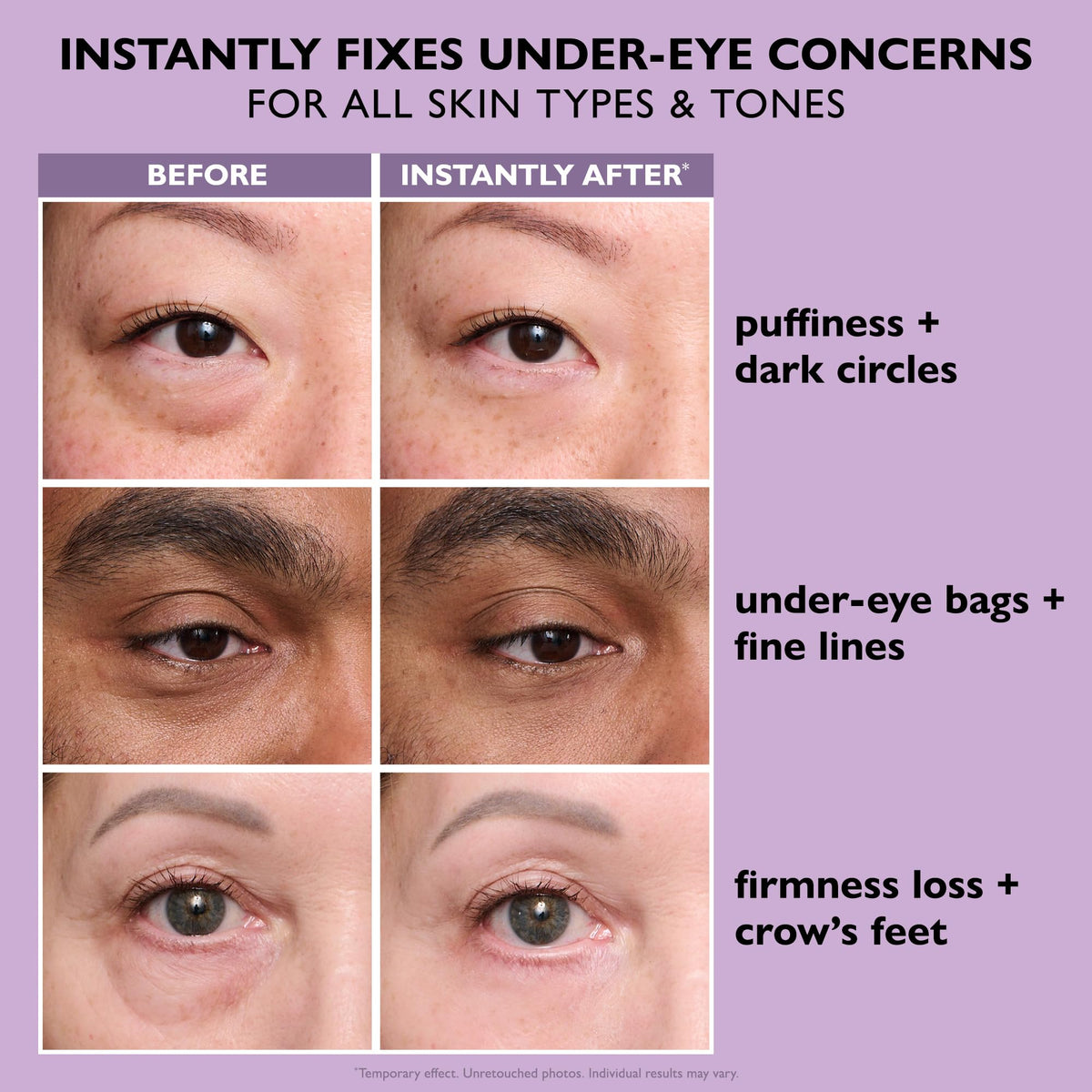 Peter Thomas Roth before and after under‑eye showing visible instant tightening