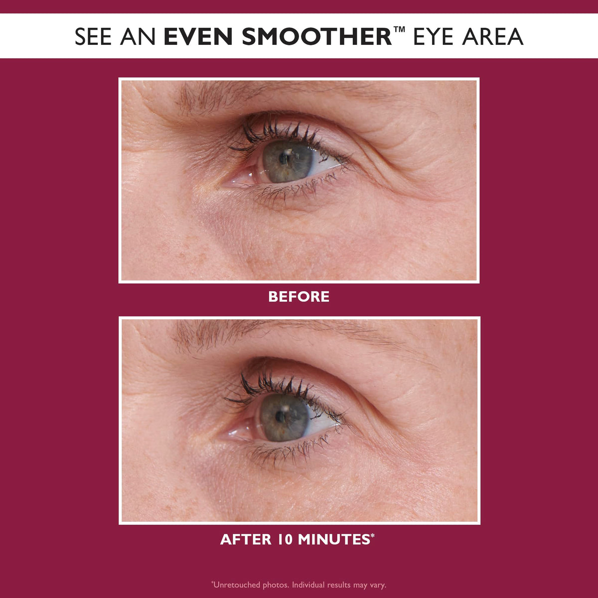 Peter Thomas Roth patch applied under-eye showing targeted smoothing