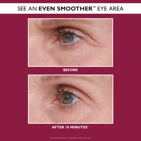 Peter Thomas Roth patch applied under-eye showing targeted smoothing