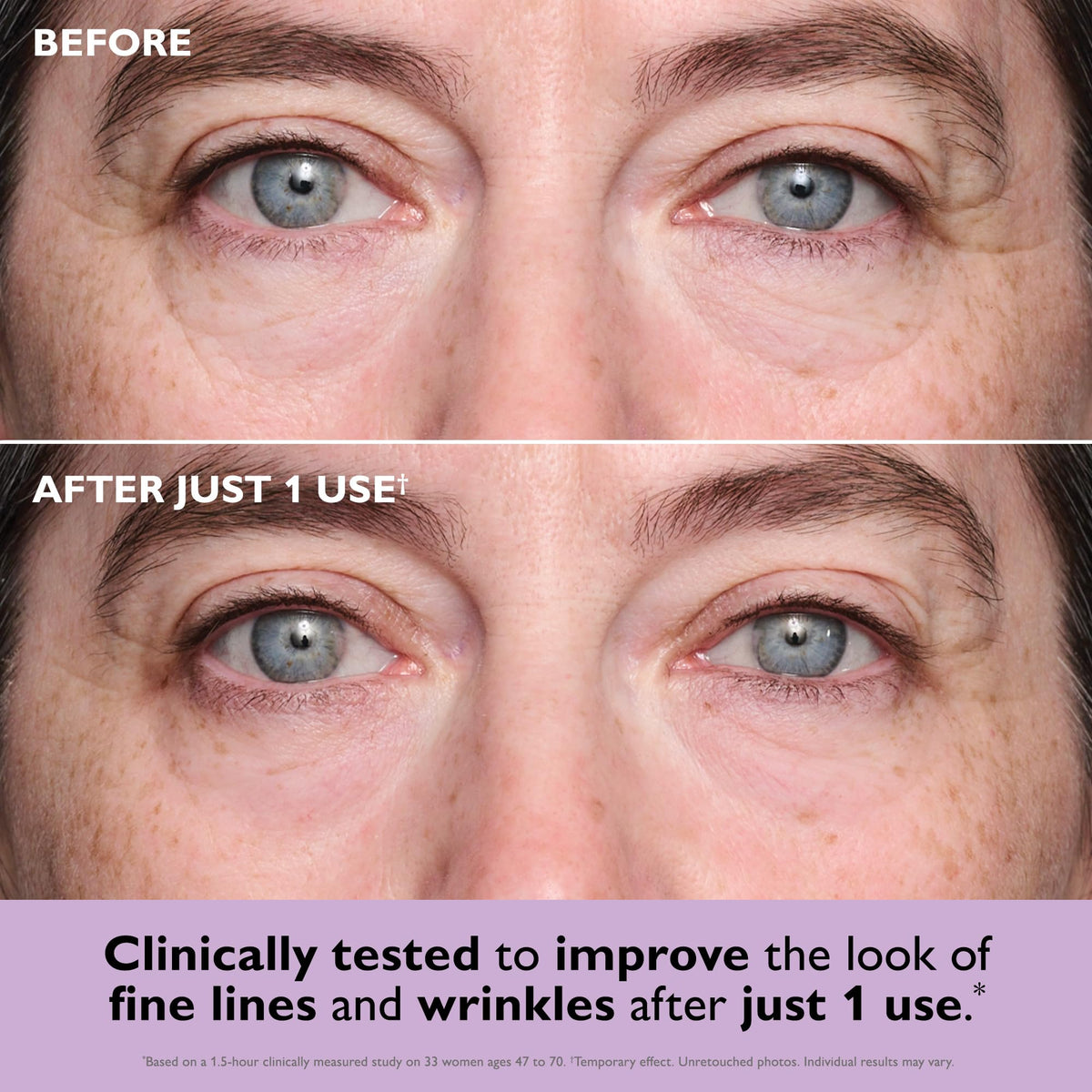 Peter Thomas Roth close-up of gel patch highlighting smooth texture