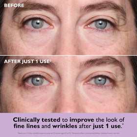 Peter Thomas Roth close-up of gel patch highlighting smooth texture