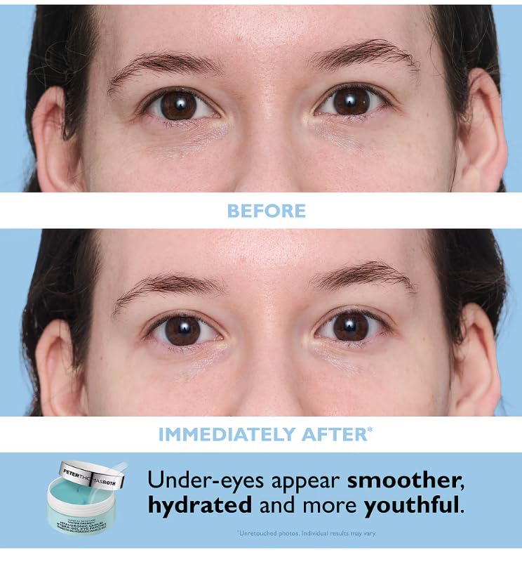Peter Thomas Roth patches held in hand demonstrating easy application and travel convenience