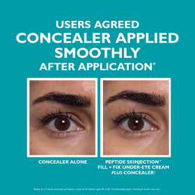 Before and after comparison illustrating improved under-eye volume and brighter appearance