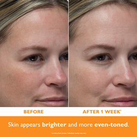 Peter Thomas Roth serum drop on hand showing lightweight texture benefit