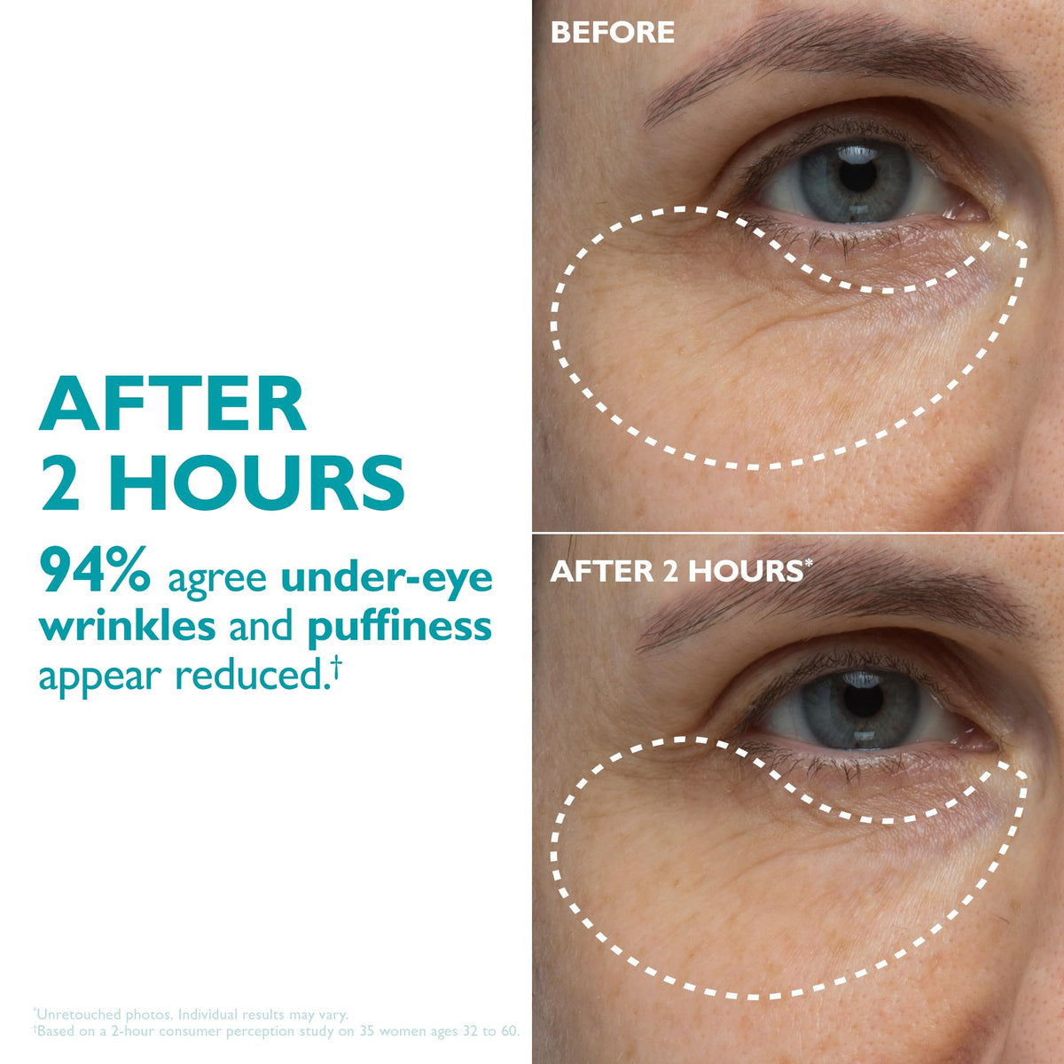 peter thomas roth tape beside hand to show true size and scale