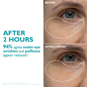 peter thomas roth tape beside hand to show true size and scale
