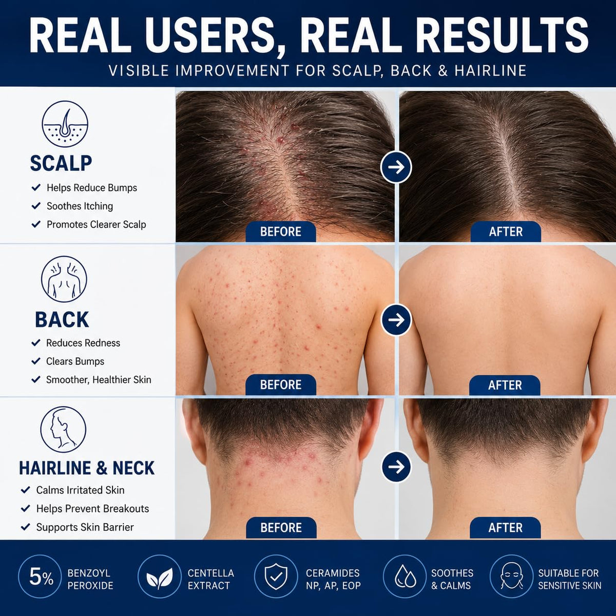 Peunitory applying cream to scalp showing spot treatment and reduced residue