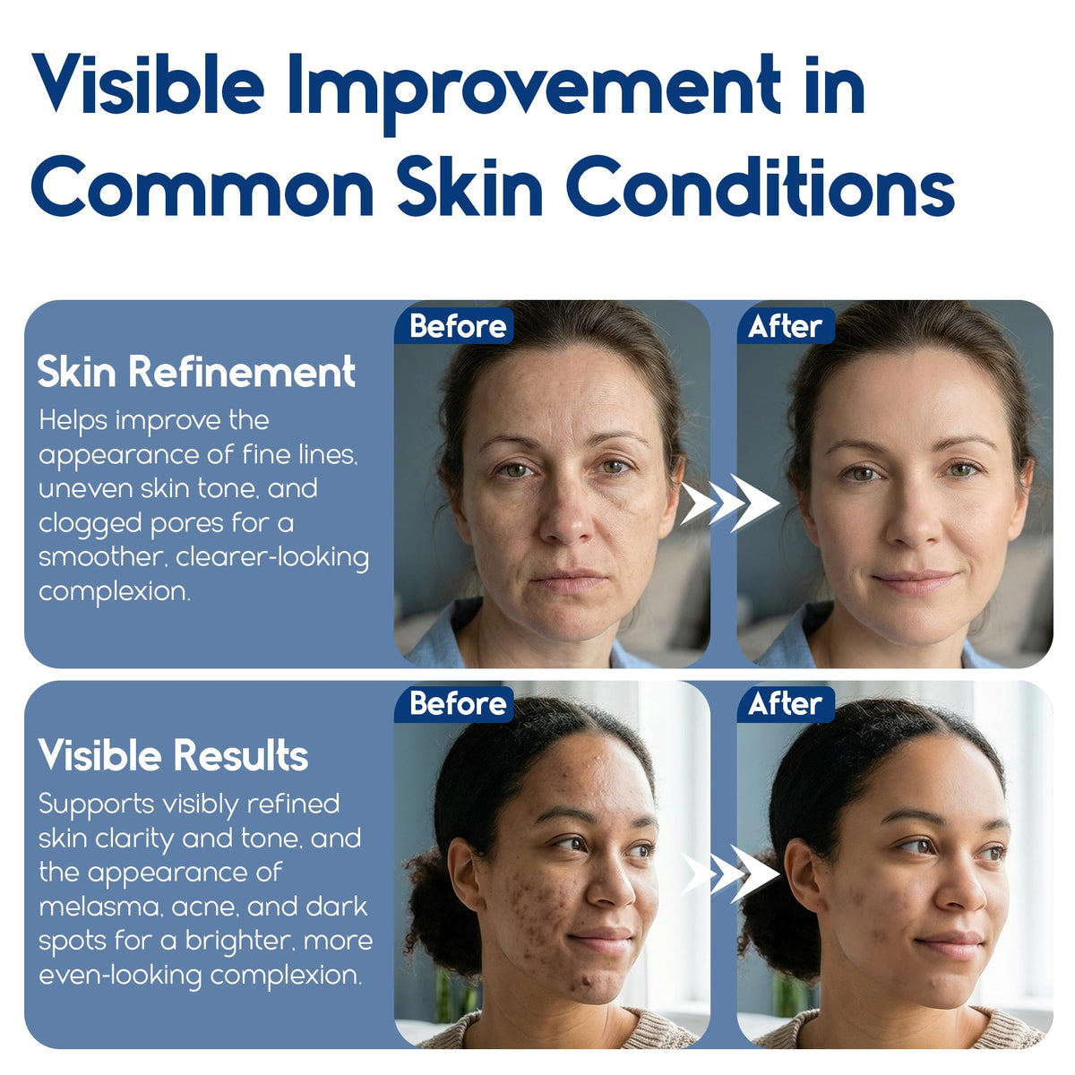 Pharmlitalia pad smoothing heel skin illustrating rough spot refinement