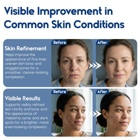 Pharmlitalia pad smoothing heel skin illustrating rough spot refinement