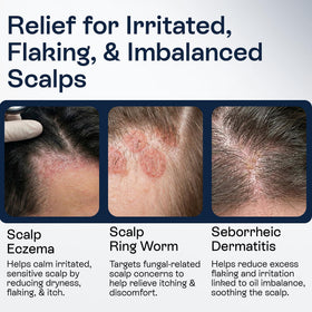 Pharmlitalia applying spray at hairline to soothe flakes and itching
