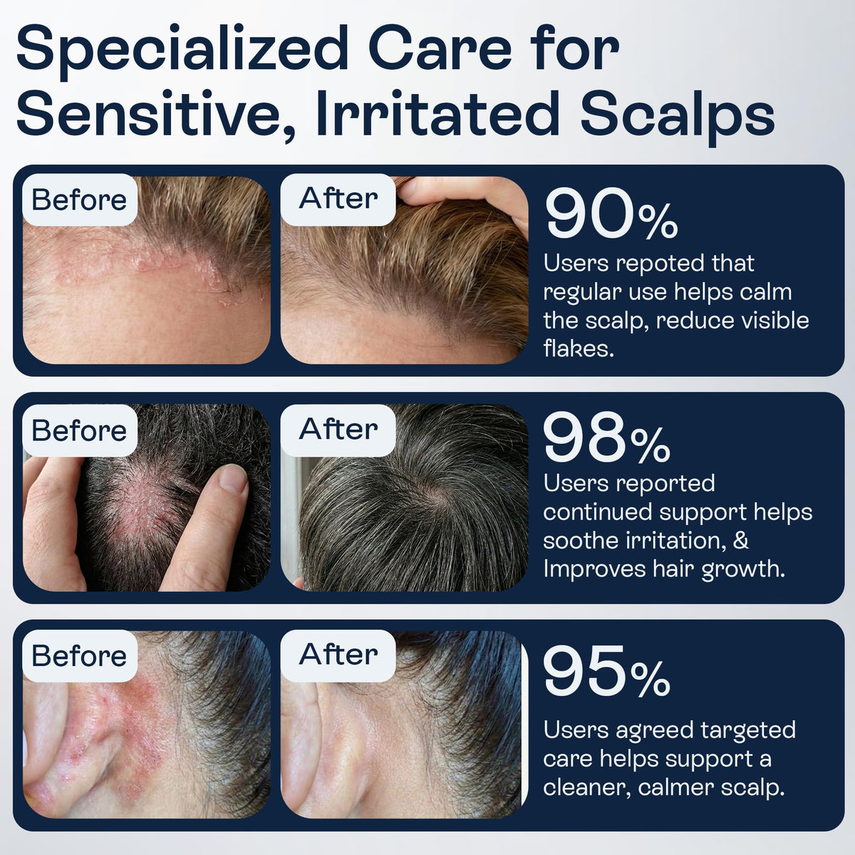 Pharmlitalia before and after scalp comparison showing reduced visible flakes