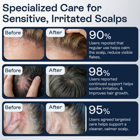 Pharmlitalia before and after scalp comparison showing reduced visible flakes