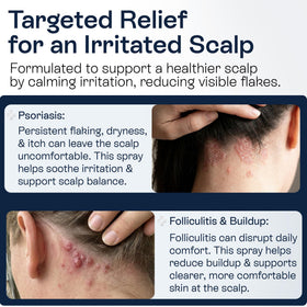 Pharmlitalia spray nozzle close-up demonstrates precise easy application