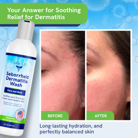 pHat 5.5 applied to face and neck illustrating gentle cleansing for sensitive skin