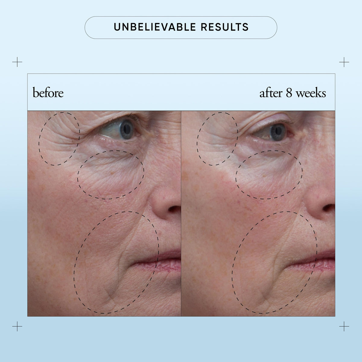 philosophy serum pictured in a morning routine setting to show layering with moisturizer and SPF