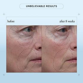 philosophy serum pictured in a morning routine setting to show layering with moisturizer and SPF