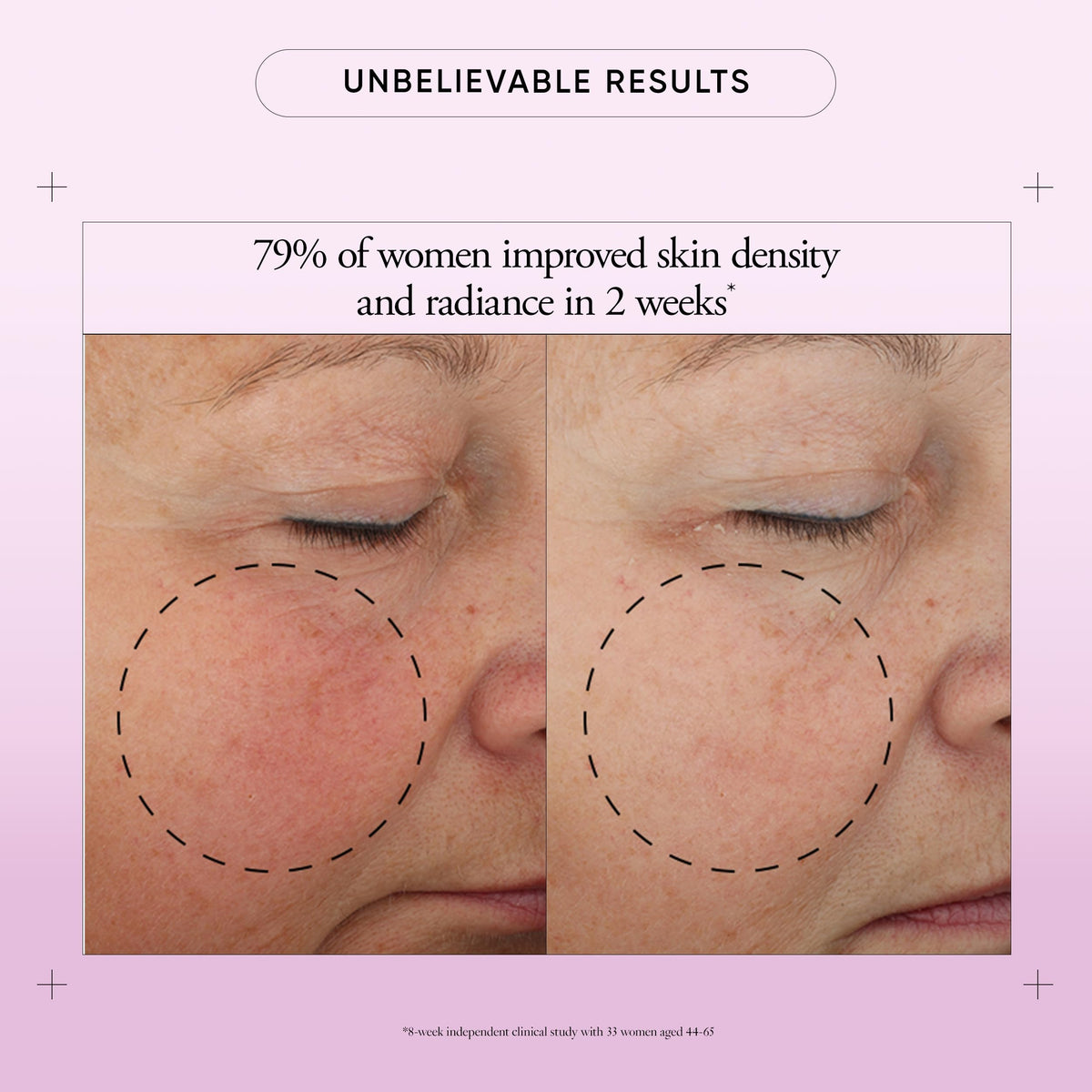 philosophy open jar texture of cream highlighting smooth, hydrating finish