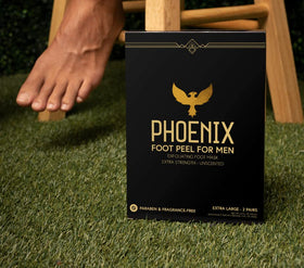 Before-and-after heels after Phoenix Foot Peel treatment showing smoother skin