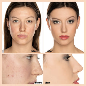 PHOERA dispensing drop close-up demonstrating controlled application benefit