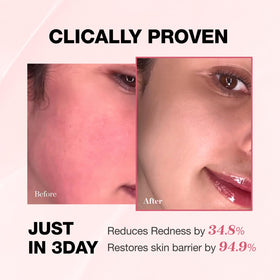 PHYSIOGEL cream applied on hand illustrating instant calming hydration